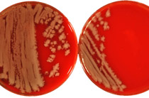 Koloniewachstum eines aeroben Sporenbildners (Bacillus sp.) auf Blutagar ohne Hämolyse. Quelle: © Bredow/RKI